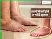इन 5 कारणों से तलवों में होने लगती है सूजन, संकेत दिखते ही कराएं जांच