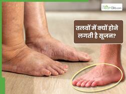 इन 5 कारणों से तलवों में होने लगती है सूजन, संकेत दिखते ही कराएं जांच