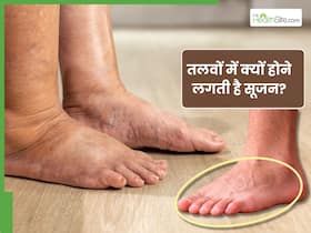 इन 5 कारणों से तलवों में होने लगती है सूजन, संकेत दिखते ही कराएं जांच