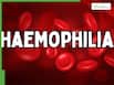World Haemophilia Day 2026: Is haemophilia hereditary? Understanding x-linked inheritance, symptoms, and risks for children