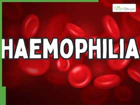 World Haemophilia Day 2026: Is haemophilia hereditary? Understanding x-linked inheritance, symptoms, and risks for children