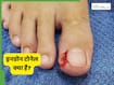 क्या है नाखून से जुड़ी समस्या 