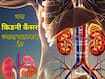 किडनी कैंसर क्या है? यह Kidney को कैसे नुकसान पहुंचाता है?