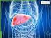 World Liver Day 2026: Alcohol vs lifestyle, what’s really harming your liver more?