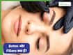 Botox और Fillers क्या पूरी तरह सुरक्षित हैं? करवाने से पहले जानें सभी जानकारी