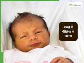 बच्चे को पीलिया होने पर क्या करना चाहिए और क्या नहीं, बता रहें डॉक्टर