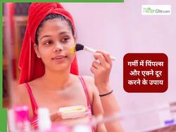 गर्मियों में पिंपल्स और एक्ने नहीं करेंगे परेशान, बस अपना लें डॉक्टर अप्रूव ये 5 तरीके