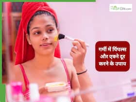 गर्मियों में पिंपल्स और एक्ने नहीं करेंगे परेशान, बस अपना लें डॉक्टर अप्रूव ये 5 तरीके