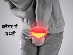 पेशाब की थैली (ब्लैडर) में पथरी क्यों होती है? डॉक्टर से जानें इसके 5 लक्षण और कारण
