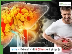 NAFLD: शराब न पीने वालों में भी फैटी लिवर क्यों होता है? जानिए कारण और लक्षण