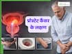 प्रोस्टेट कैंसर के शुरुआती लक्षण क्या होते हैं? जानें स्थिति कब बनती है गंभीर