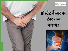 प्रोस्टेट कैंसर है या नहीं कैसे पता करें? डॉक्टर से जानें पुरुषों को कब शुरू कराना चाहिए टेस्ट