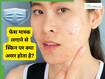 मास्क से होने वाली स्किन प्रॉब्लम से कैसे बचें? लें स्किन एक्सपर्ट की सलाह