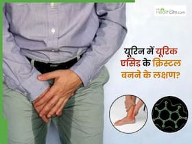 पेशाब में यूरिक एसिड के क्रिस्टल दिखने के संकेत क्या हैं?