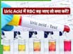 बिना बीमारी या लक्षण के अगर यूरिक एसिड टेस्ट में RBC बढ़ा हुआ आए तो क्या करें?