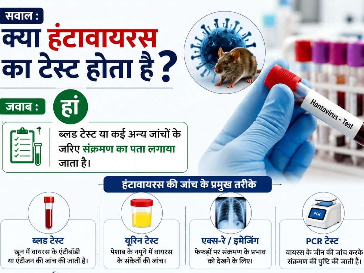 Hantavirus (image Source: ChatGPT)