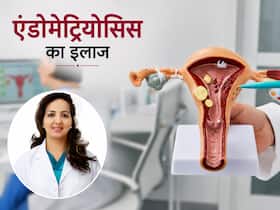 एंडोमेट्रियोसिस का इलाज न करवाने से क्या होता है? VIDEO में डॉक्टर बता रहे हैं कब यह इनफर्टिलिटी का कारण बन जाता है