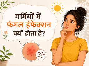 गर्मियों में वजाइनल इंफेक्शन क्यों बढ़ता है? VIDEO में डॉक्टर बता रहे हैं इस स्थिति में क्या करें