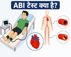 ABI टेस्ट क्या है? डॉक्टर बता रहे हैं क्या है हार्ट हेल्थ का यह आसान स्क्रीनिंग तरीका