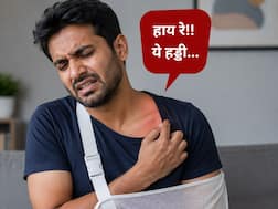 क्लेविकल फ्रैक्चर क्या होता है? क्या कॉलर बोन टूटने पर हमेशा सर्जरी जरूरी होती है?
