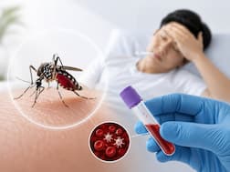 World Dengue Day 2026: Sudden platelet drop can turn a viral fever into a medical emergency | WATCH VIDEO