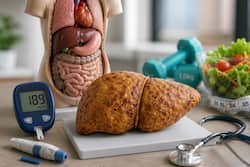 Fatty liver in type 1 diabetes may signal broader metabolic problems, study finds