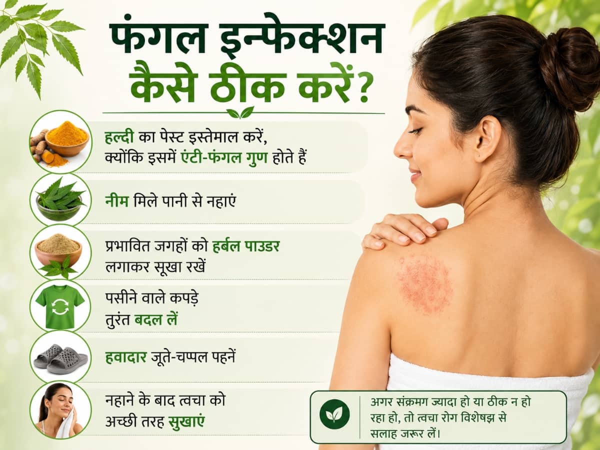 फंगल इंफेक्शन