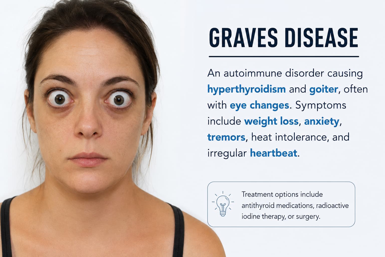 Graves Disease