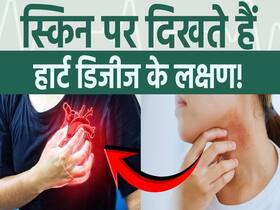 स्किन पर दिखने वाले हार्ट डिजीज के साइन, कौन-से लक्षण हैं जिन्हें नहीं करना चाहिए इग्नोर