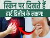 स्किन पर दिखने वाले हार्ट डिजीज के साइन, कौन-से लक्षण हैं जिन्हें नहीं करना चाहिए इग्नोर