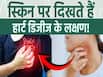 स्किन पर दिखने वाले हार्ट डिजीज के साइन, कौन-से लक्षण हैं जिन्हें नहीं करना चाहिए इग्नोर