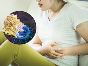 Higher cancer risk seen in CKM syndrome; experts recommend precautions