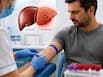 Liver Function Test (LFT): What your numbers reveal about your liver health