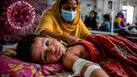Not Ebola but deadly Measles is sweeping through Bangladesh: 500 dead, over 60,000 infected in the latest 2026 outbreak