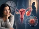 Why perimenopausal women face higher risk of ovarian cancer