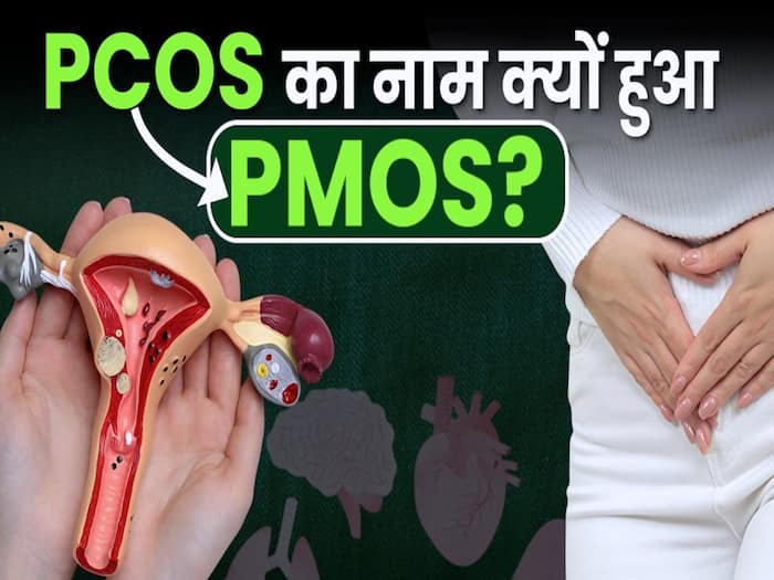 PCOS का नाम बदलकर PMOS क्यों हुआ? New PCOS Name Explained