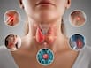 5 red flags of papillary thyroid cancer you shouldn’t ignore