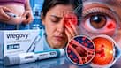 Popular weight loss drug Wegovy linked to eye stroke - a condition that can leave you blind forever, study warns