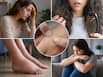 Protein deficiency warning signs: 5 symptoms that show your body may not be getting enough protein