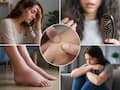 Protein deficiency warning signs: 5 symptoms that show your body may not be getting enough protein