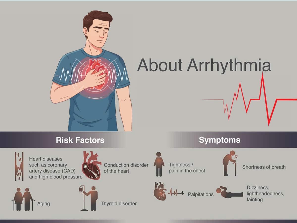 Risk factors and symptoms of arrhythmia.