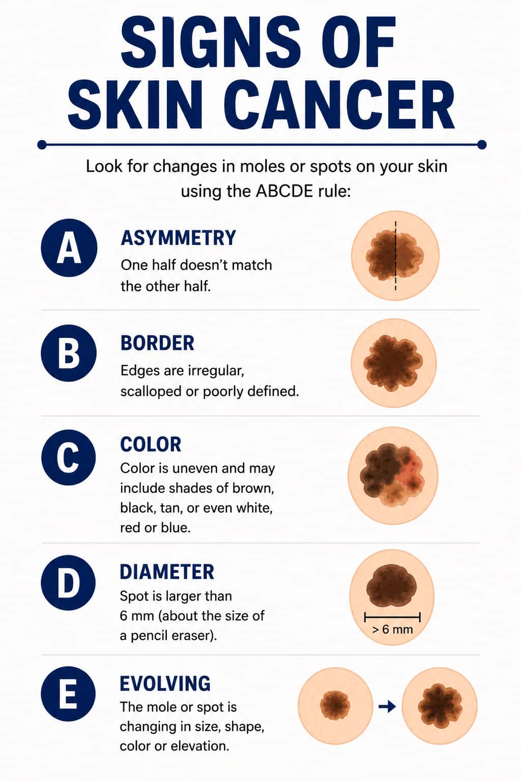Signs of skin cancer