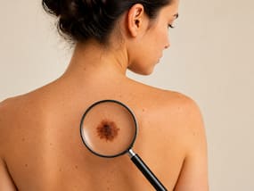 Chinese scientists sound alarm over massive global skin cancer surge by 2050: Prevention tips you should know