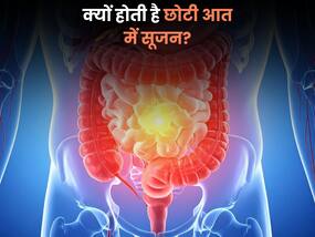 छोटी आंत में सूजन क्यों आती है? क्या है इसके पीछे की वजह