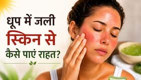 धूप से चेहरा जल जाए, तो क्या करें? जानें स्किनकेयर के 5 तरीके