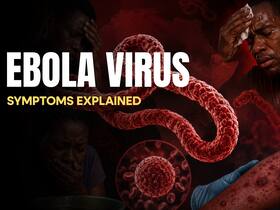 Ebola virus: 5 symptoms of this deadly virus that killed over 134 people in Congo