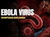 Ebola virus outbreak: 5 symptoms of this deadly virus that killed over 134 people in Congo