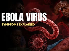 Ebola virus outbreak: 5 symptoms of this deadly virus that killed over 134 people in Congo