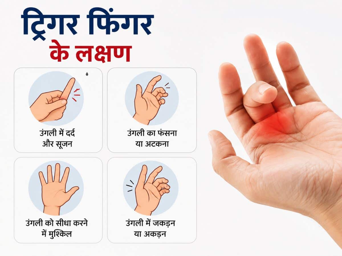 Symptoms of Trigger Finger