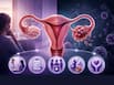 What happens if ovarian cancer relapses? 5 things doctors want you to know about protecting ovarian health